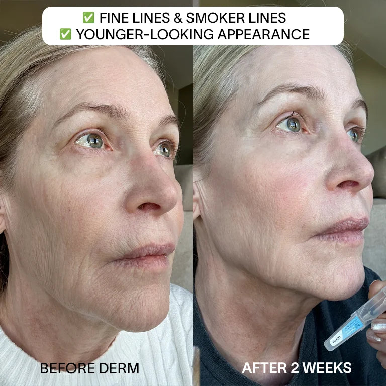 Youthful Skin Bundle