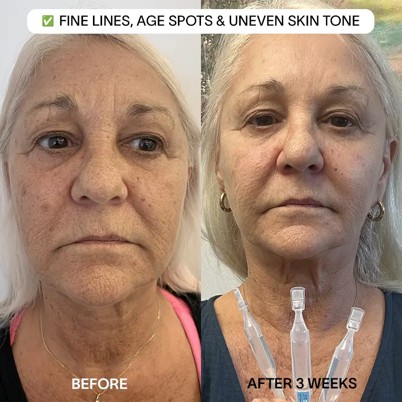 THE DRM LAB 3% Hyaluronic Acid Serum