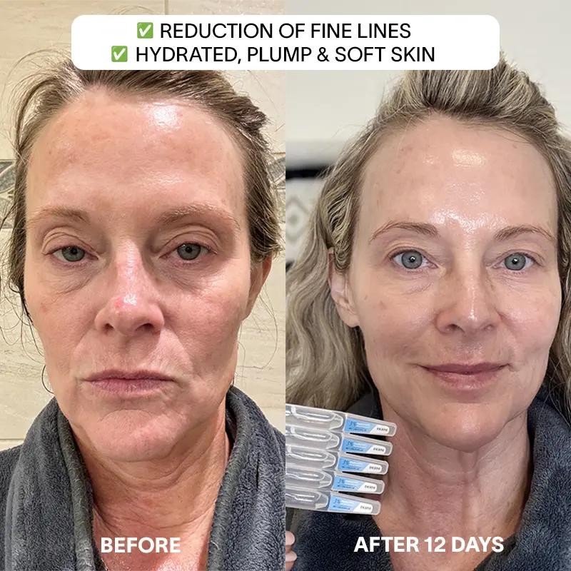 THE DRM LAB 3% Hyaluronic Acid Serum