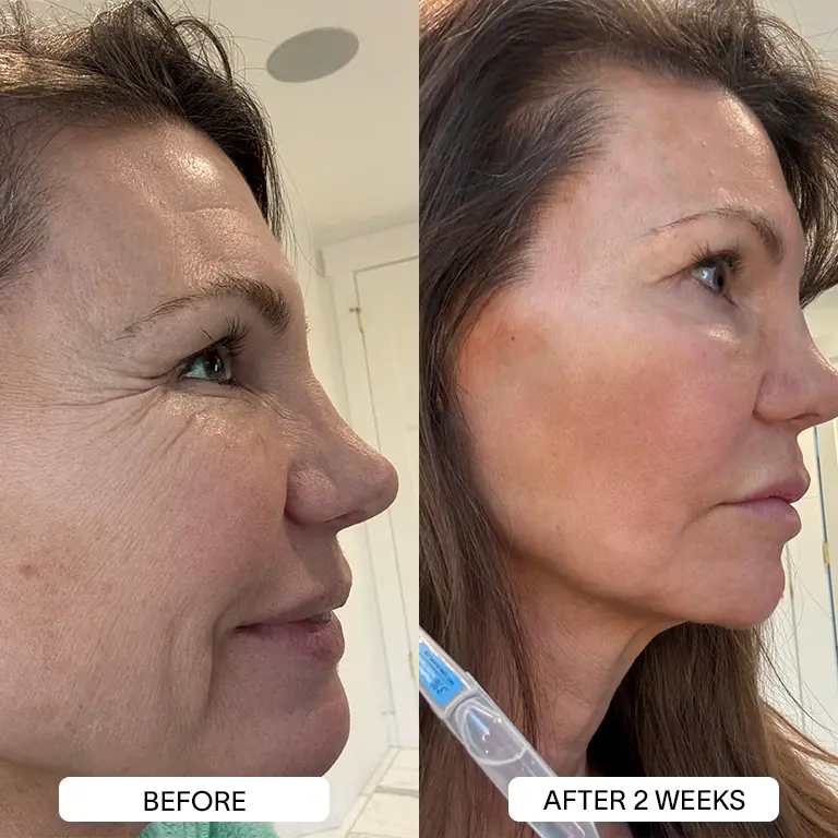 THE DRM LAB 3% Hyaluronic Acid Serum