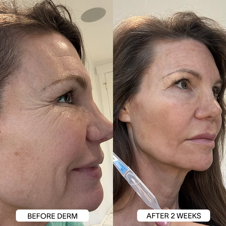 Derm™ 3% Hyaluronic Acid - Cyber Monday Sale