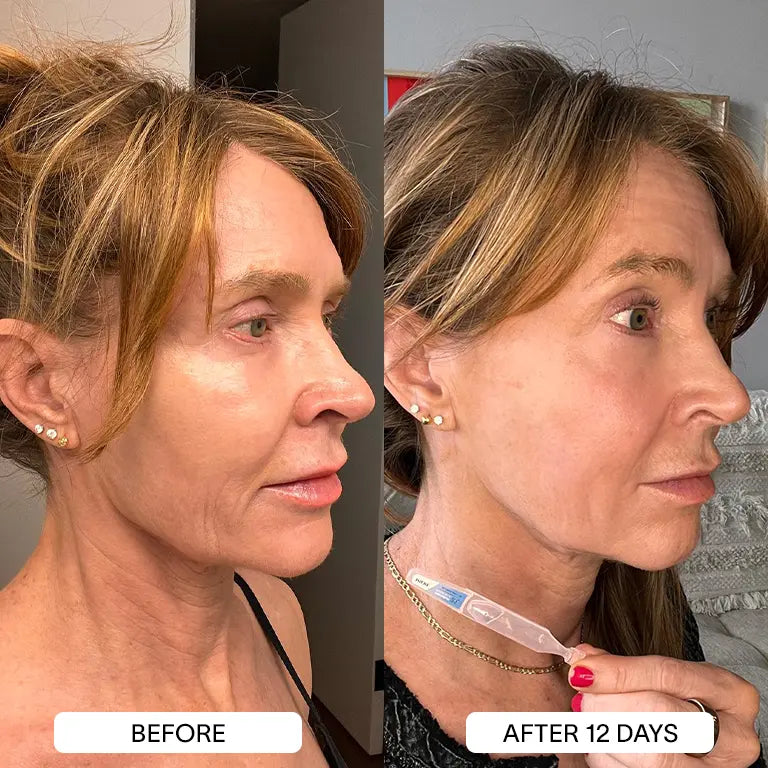 THE DRM LAB 3% Hyaluronic Acid Serum