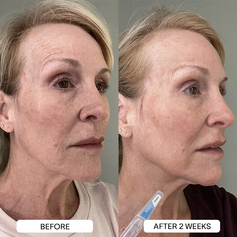 THE DRM LAB 3% Hyaluronic Acid Serum